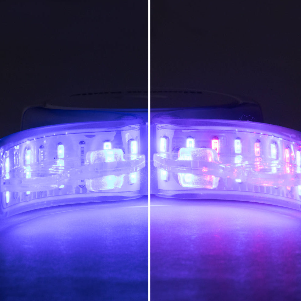 ProGlow Professional Teeth Whitening Kit