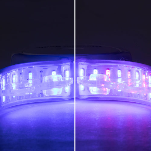 ProGlow Professional Teeth Whitening Kit